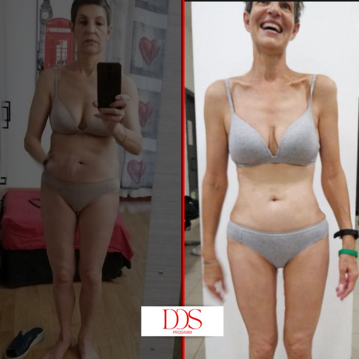 Trasformazione prima e dopo — cliente 15